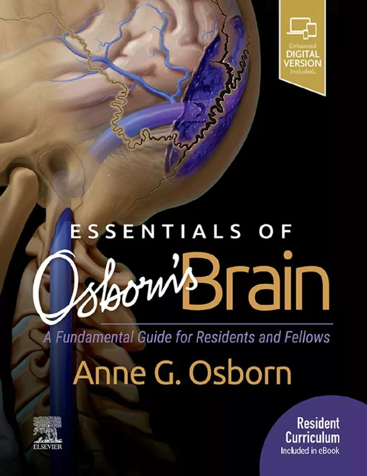 Essentials of Osborn’s Brain – PDF